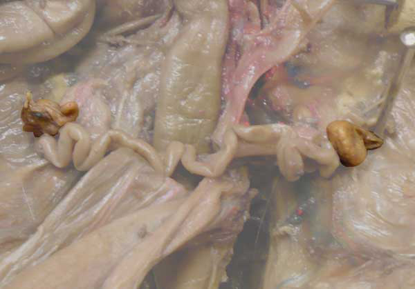 Ureter