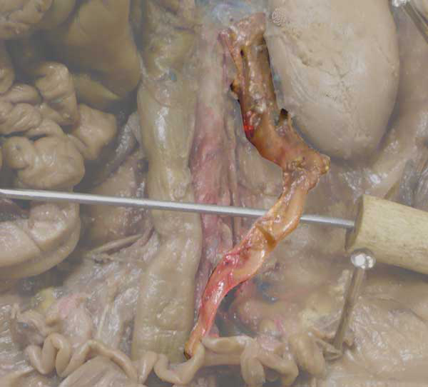 Ureter