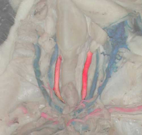 Carotid Arteries