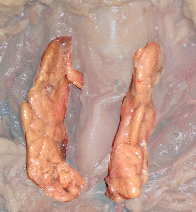 Thymus